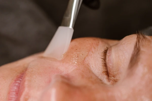 skin repeel met silicone kwast aangebracht op de huid
